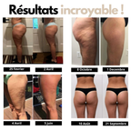 Leggings 3D anti cellulite Zelvana® Zelvana